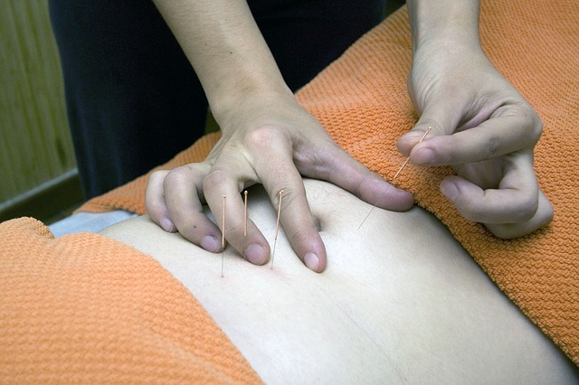 woman undergoing acupuncture treatment